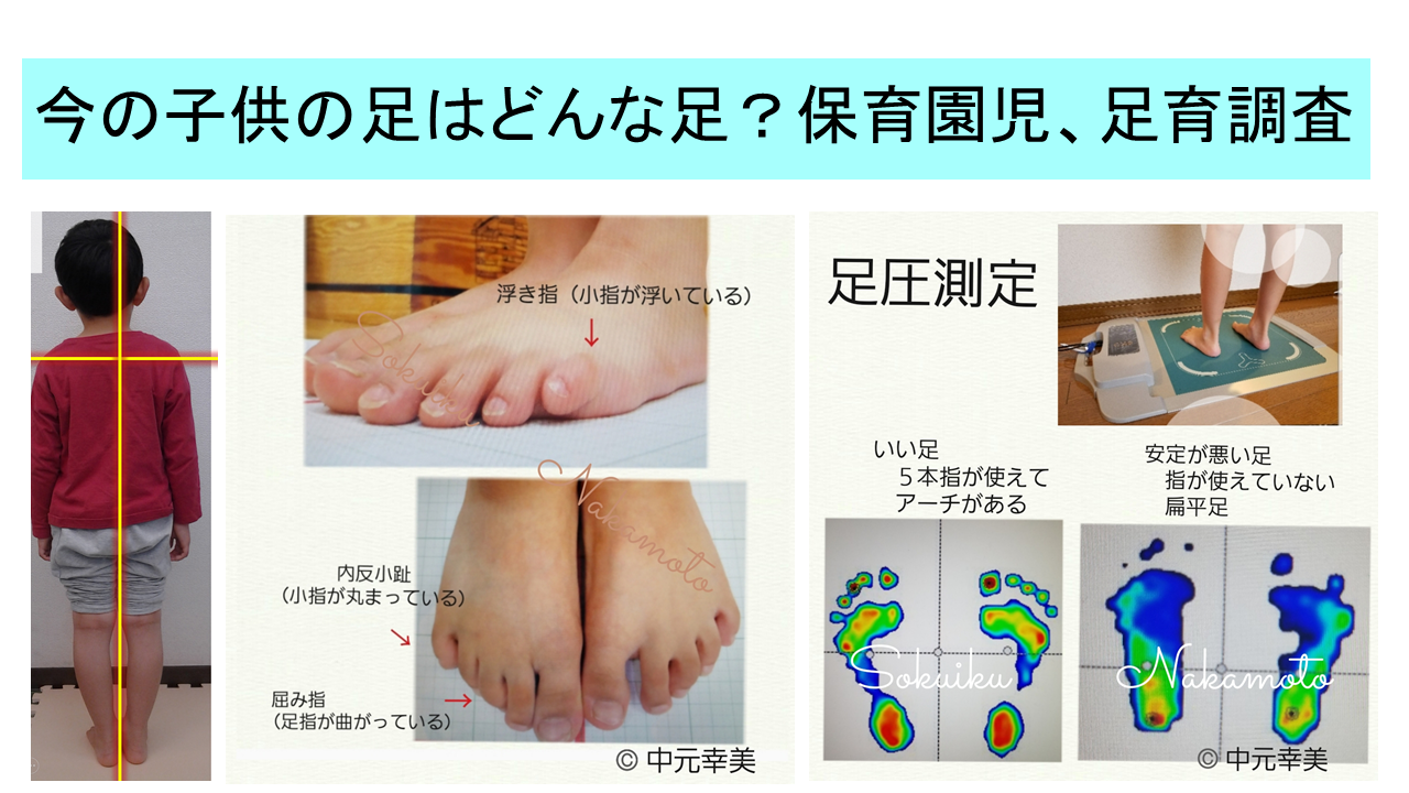 今の子供の足はどんな足 保育園児足育調査 足歩